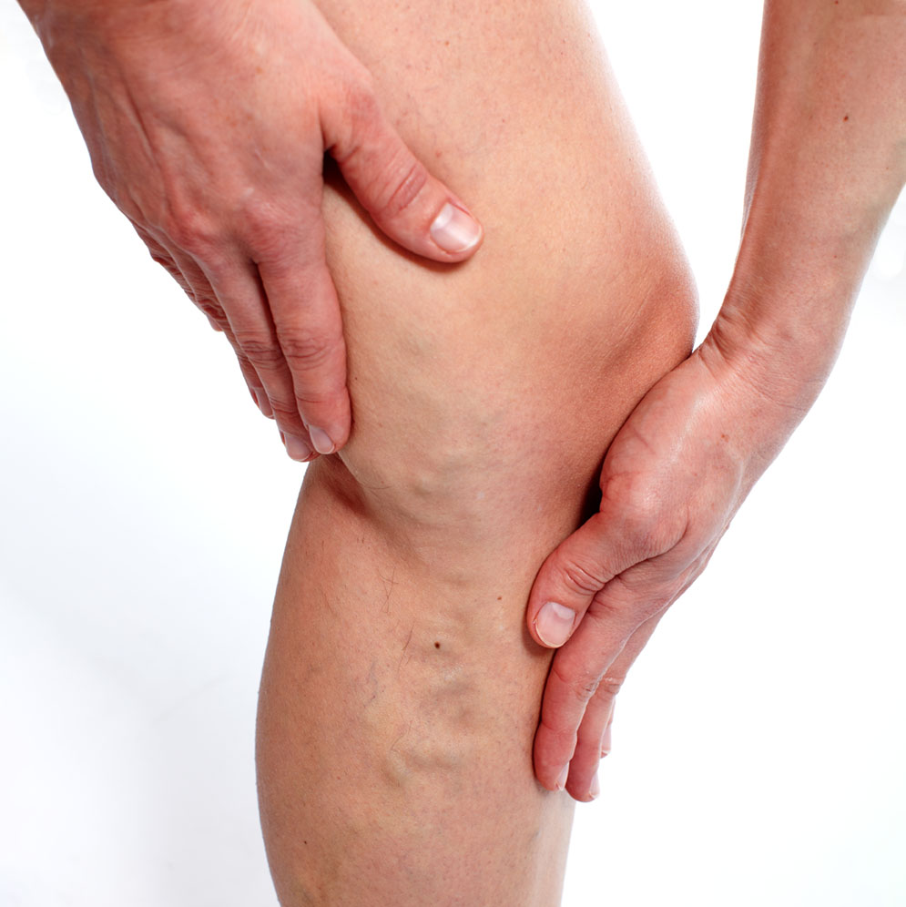 woman rubs varicose veins in her mid calf